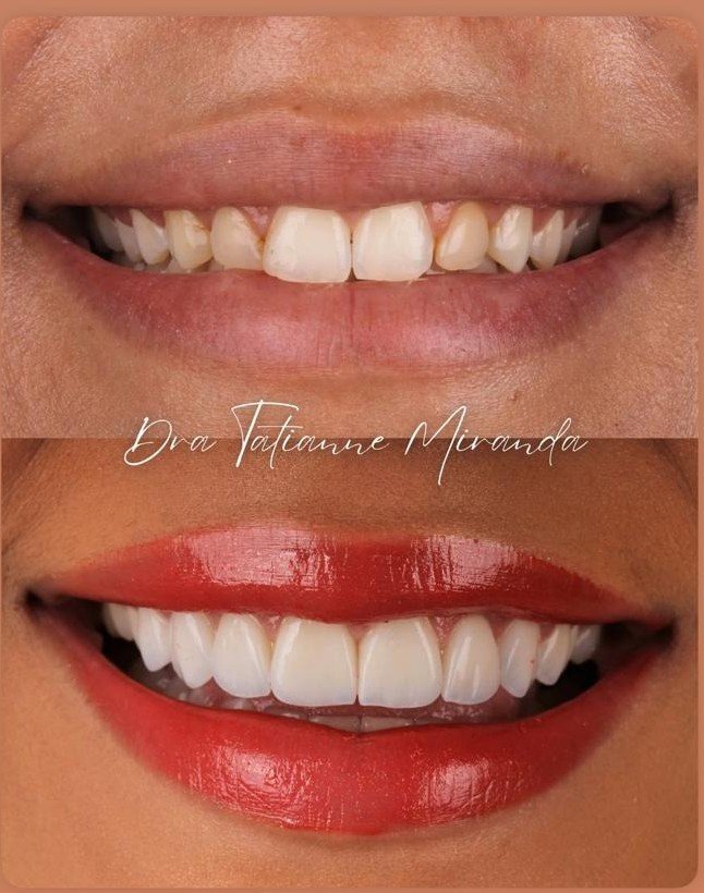 Transformação do Sorriso